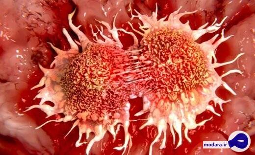 کدام سرطان ها در مردان شایع است؟