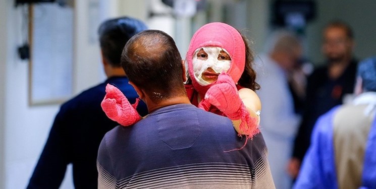 آسیب‌دیدگی چشم بانوی ۴۰ ساله اردستانی در حوادث چهارشنبه‌سوری
