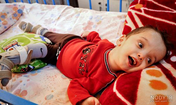 آمار کودکانی که معلول به دنیا می‌آیند «محرمانه» شد