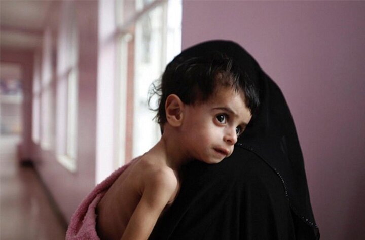 در ۷ سال گذشته ۲۷% به آمار جمعیت دچار سوء‌تغذیه کشور اضافه شده است
