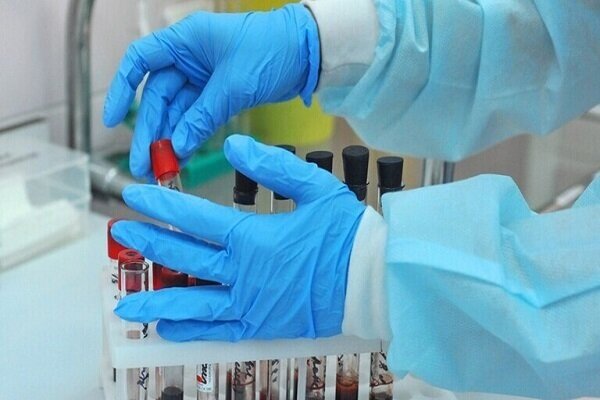 داروی بیماری سالک در اصفهان توسط دانش‌بنیان‌ها تولید شد