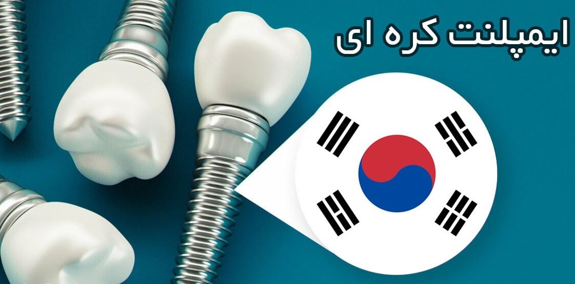 معرفی انواع برند ایمپلنت کره ‌ای