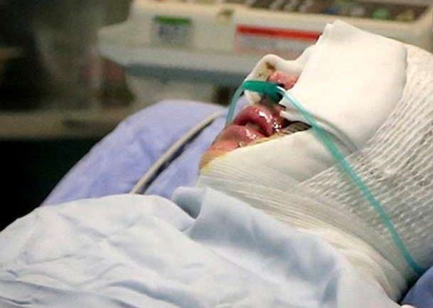 ماجرای هولناک اسیدپاشی مرد شکاک در کرج
