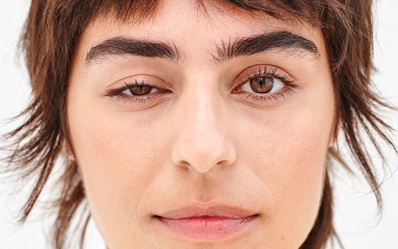 افتادگی پلک