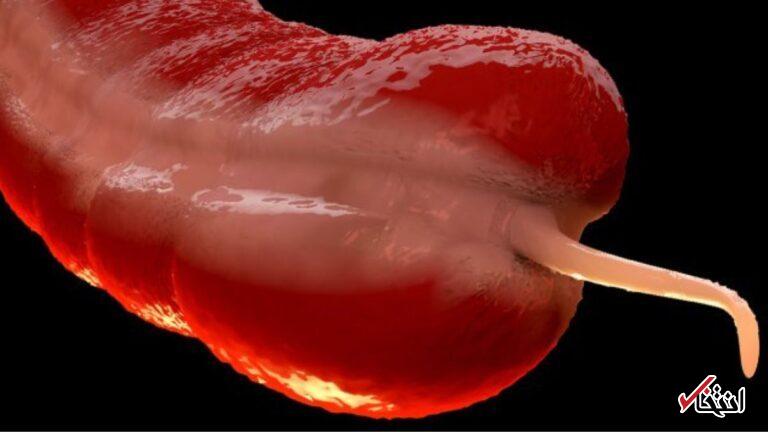 افزایش نگران‌کننده‌ی یک سرطان نادر در میان جوانان