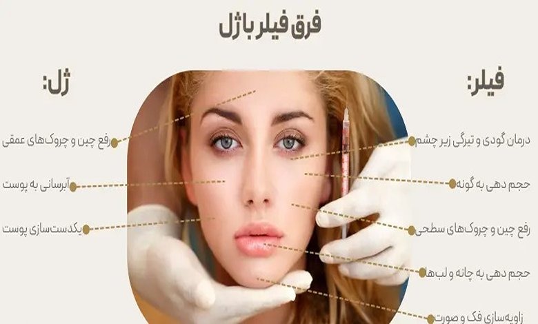 فیلر لب بهتر است یا ژل لب؟ راهنمای کامل انتخاب بهترین روش حجم‌ دهی لب